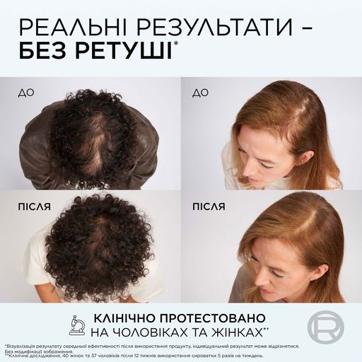 Шампунь L'Oreal Paris Elseve Growth Booster Anti-Fall Shampoo для боротьби з випадінням та ламкістю волосся, 200 мл