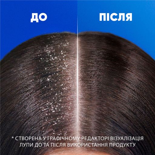 Шампунь против перхоти Head & Shoulders Против выпадения волос, 400 мл