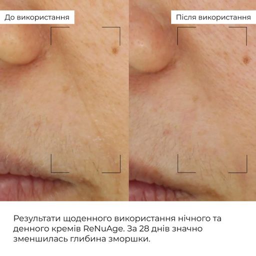 Комплекс щоденного антивікового догляду ReNuAge для всіх типів шкіри креми для обличчя та навколо очей антивіковий догляд (652748) (2039853)