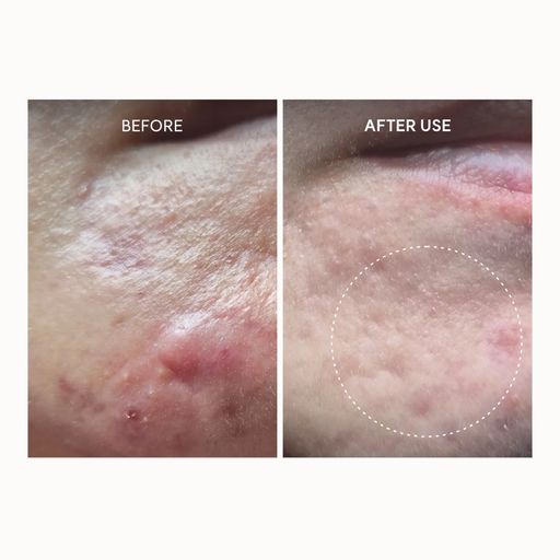 Сироватка-бустер для обличчя Arencia Eraser Shot Glycolic Acid Booster, 30 мл