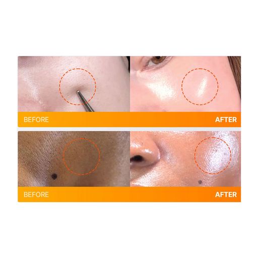Сироватка для обличчя Frankly PDRN Bounce Ball Serum, 30 мл