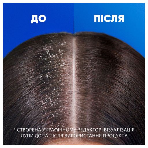 Шампунь проти лупи Head & Shoulders Цитрусова свіжість 2-в-1
