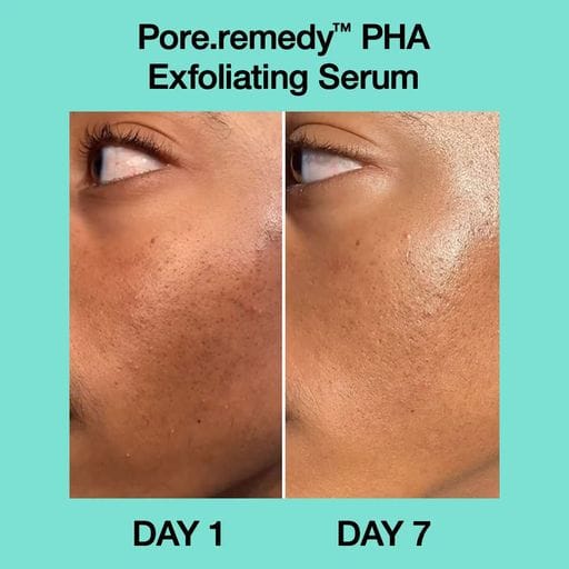 Уценка! Восстановительная сыворотка для лица Dr. Jart+ Pore·remedy PHA Exfoliating Serum, 30 мл