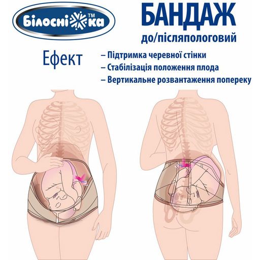 Уцінка! Бандаж до та післяпологовий Білосніжка Mod. 202, розмір 3 (95-105 см)