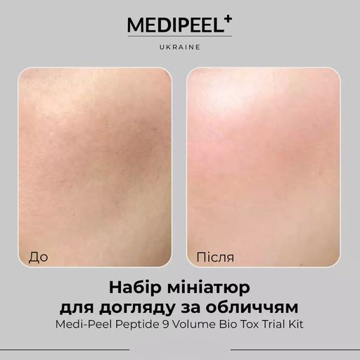 Набор для лица Medi-Peel Peptide 9 Volume Bio Tox Trial Kit, 4 продукта