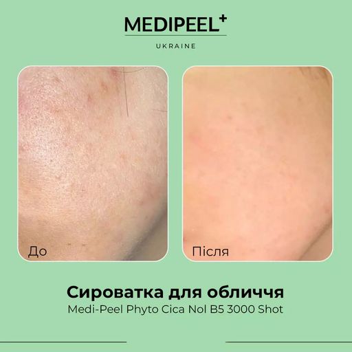 Сыворотка Medi-Peel Phyto Cica Nol B5 3000 Shot для чувствительной и проблемной кожи лица, 50 мл