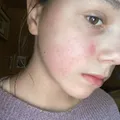 296deb9d201488a759eefafccabf1d27d28c3db4.jpeg