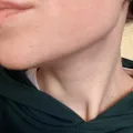 30e35634a1df44418149fc9fbed521e052ed5946.jpeg