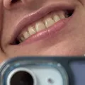 317d5bf66e71ea40e8a455d92da27c81ea03daa2.jpeg