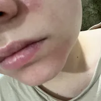 1169b339d9fbf56dde27282abdad2093eb45ea5e.jpeg