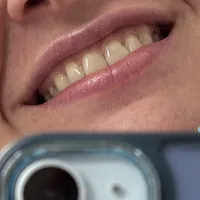 317d5bf66e71ea40e8a455d92da27c81ea03daa2.jpeg