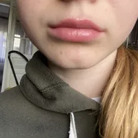 34d25ddb01e67ce0f3155020b1964fda32f82cf3.jpeg