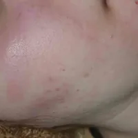 41981a30594569a2b8af8caa380d806cd1345f8c.jpeg