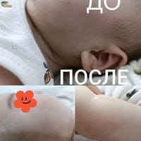 a2cd79f62e9e036128d2c3a09a56ede1ae5c088b.jpeg