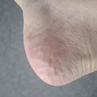 c4179b83fe4a0c71b1eb46657642a79a64223c2b.jpeg