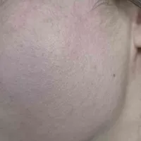 e501b99fc1d18d472b1651c5b4e532400fe31d67.jpeg